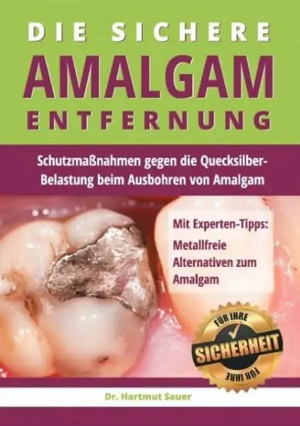 Die sichere Amalgam-Entfernung - Buch