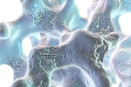 Osteoporose, brüchiger Knochen